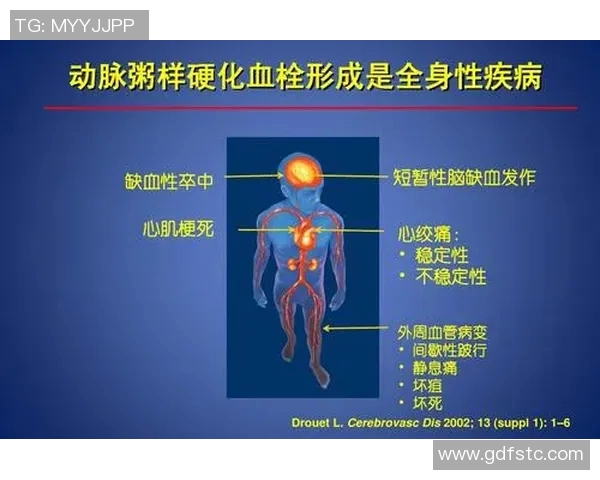 文班谈血栓伤病的医学分析与心理状态的积极应对 文班谈血栓伤病的医学分析与心理状态的积极应对